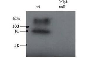 Image no. 2 for anti-Melanophilin (MLPH) (C-Term) antibody (ABIN374219) (Melanophilin 抗体  (C-Term))
