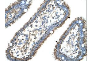 CPS1 antibody was used for immunohistochemistry at a concentration of 4-8 ug/ml. (CPS1 抗体  (Middle Region))