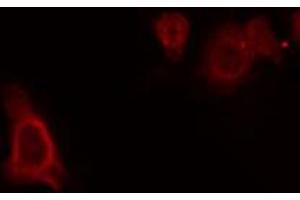 Immunofluorescence (fixed cells) (IF/ICC) image for anti-G Protein-Coupled Receptor, Family C, Group 5, Member C (GPRC5C) antibody (ABIN6262062)