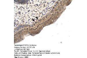 Human Spermatophore (TFCP2L1 抗体  (N-Term))