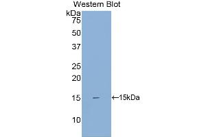 Western blot analysis of the recombinant protein. (SIGIRR 抗体  (AA 1-118))