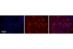 Immunohistochemistry (IHC) image for anti-Cytochrome P450, Family 4, Subfamily F, Polypeptide 3 (CYP4F3) (N-Term) antibody (ABIN2777012)