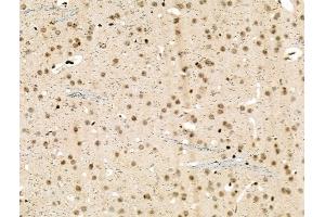 Phospho-NMDAR2A (Ser1155) Antibody at 1/100 staining Mouse brain tissue by IHC-P. (NMDAR2A 抗体  (pSer1155))