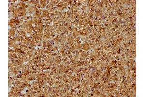 IHC image of ABIN7171626 diluted at 1:400 and staining in paraffin-embedded human adrenal gland tissue performed on a Leica BondTM system. (TBC1D25 抗体  (AA 1-219))