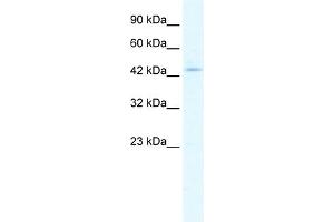 WB Suggested Anti-CLIC5 Antibody Titration:  1. (CLIC5 抗体  (Middle Region))