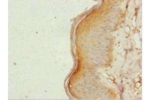 Immunohistochemistry of paraffin-embedded human skin tissue using ABIN7161952 at dilution of 1:100 (ZC3HC1 抗体  (AA 1-260))