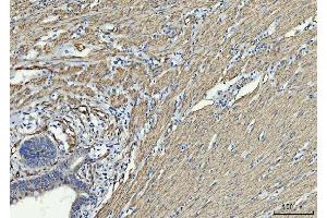 IHC analysis of TP53I13 using anti-TP53I13 antibody (ABIN7601220). (TP53I13 抗体  (AA 30-365))