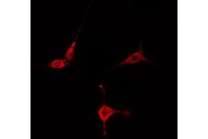 ABIN6274754 staining COLO205 cells by IF/ICC. (RPS27L 抗体  (N-Term))