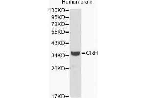 Western Blotting (WB) image for anti-Corticotropin Releasing Hormone (CRH) (AA 25-194) antibody (ABIN6215115) (CRH 抗体  (AA 25-194))