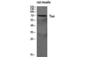 Western Blotting (WB) image for anti-tau Protein (Ser83) antibody (ABIN3187174) (tau 抗体  (Ser83))