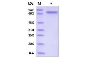 SDS-PAGE (SDS) image for Sema Domain, Immunoglobulin Domain (Ig), Transmembrane Domain (TM) and Short Cytoplasmic Domain, (Semaphorin) 4A (Sema4a) (AA 33-683) protein (His tag) (ABIN2181737)