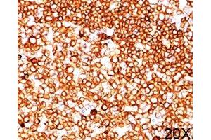 IHC testing of human tonsil (20X) stained with CD79a antibody (JCB117). (CD79a 抗体  (AA 202-216))