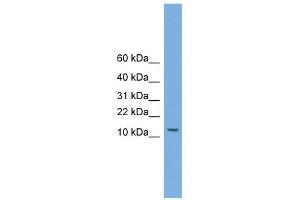 MAGEA5 antibody used at 1 ug/ml to detect target protein. (MAGEA5 抗体  (N-Term))