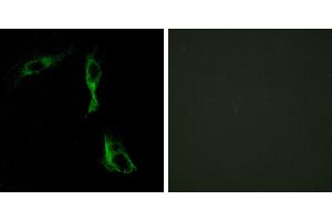 Peptide - +Immunohistochemistry analysis of paraffin-embedded human breast carcinoma tissue using ADRA1D antibody. (ADRA1D 抗体)