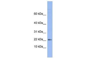 RPS24 antibody used at 1 ug/ml to detect target protein. (RPS24 抗体  (Middle Region))