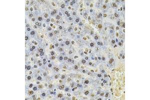 Immunohistochemistry (IHC) image for anti-Proteasome (Prosome, Macropain) 26S Subunit, ATPase, 3 (PSMC3) (AA 1-180) antibody (ABIN3022705)
