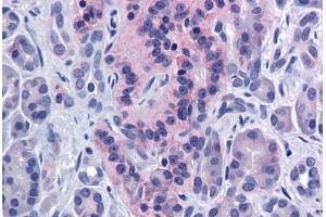 Human Pancreas: Formalin-Fixed, Paraffin-Embedded (FFPE) (SIRT4 抗体  (AA 216-265))