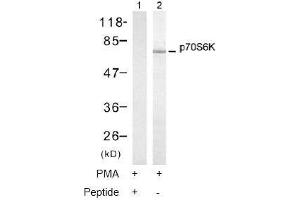 Image no. 1 for anti-Ribosomal Protein S6 Kinase, 70kDa, Polypeptide 1 (RPS6KB1) (Thr421) antibody (ABIN197498) (RPS6KB1 抗体  (Thr421))
