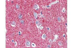 Immunohistochemistry (IHC) image for anti-Solute Carrier Family 25, Member 28 (SLC25A28) (C-Term) antibody (ABIN2781696) (SLC25A28 抗体  (C-Term))