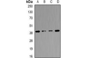 Western blot analysis of Tropomodulin-4 expression in mouse heart (A), mouse skeletal muscle (B), mouse brain (C), rat skeletal muscle (D) whole cell lysates. (Tropomodulin 4 抗体)