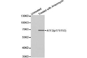 Western Blotting (WB) image for anti-Activating Transcription Factor 2 (ATF2) (pThr53) antibody (ABIN1869992) (ATF2 抗体  (pThr53))