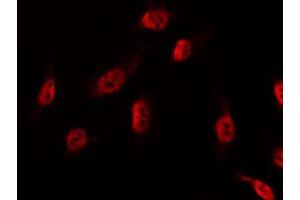 ABIN6274536 staining NIH-3T3 by IF/ICC. (DBF4 抗体  (Internal Region))