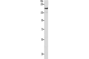 Gel: 10 % SDS-PAGE, Lysate: 40 μg, Lane: A549 cells, Primary antibody: ABIN7191635(NFASC Antibody) at dilution 1/400, Secondary antibody: Goat anti rabbit IgG at 1/8000 dilution, Exposure time: 1 minute (NFASC 抗体)