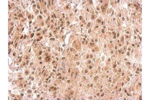 Immunohistochemistry (IHC) image for anti-Von Hippel-Lindau Tumor Suppressor, E3 Ubiquitin Protein Ligase (VHL) antibody (ABIN2854928)