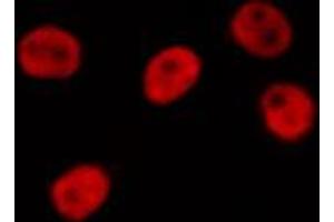 Immunofluorescence (fixed cells) (IF/ICC) image for anti-Neural Precursor Cell Expressed, Developmentally Down-Regulated 8 (NEDD8) antibody (ABIN6263583)