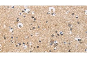 Immunohistochemistry of paraffin-embedded Human brain using CKMT2 Polyclonal Antibody at dilution of 1:60 (CKMT2 抗体)