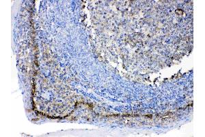 Immunohistochemistry (IHC) image for anti-Basigin (Ok Blood Group) (BSG) (AA 138-323) antibody (ABIN5518743)