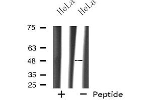 Western blot analysis of extracts from HeLa cells, using OPRM1 antibody. (Mu Opioid Receptor 1 抗体  (C-Term))