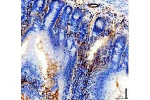 IHC analysis of CD31/Pecam1 using anti-CD31/Pecam1 antibody (ABIN7601662). (CD31 抗体  (AA 41-258))