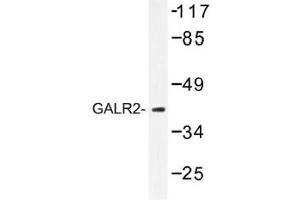 Image no. 1 for anti-Galanin Receptor 2 (GALR2) antibody (ABIN317752) (GALR2 抗体)