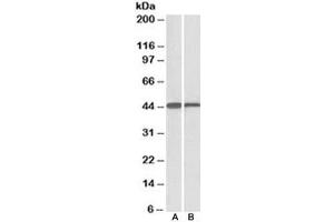 Western blot testing of mouse [A] and rat [B] liver lysate with ACAT1 antibody at 0. (ACAT1 抗体)