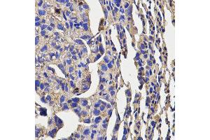 Immunohistochemistry of paraffin-embedded mouse lung cancer using KLRD1 antibody at dilution of 1:200 (x400 lens) (CD94 抗体)