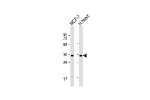 All lanes : Anti-GPD1L Antibody (N-term) at 1:1000 dilution Lane 1: MCF-7 whole cell lysate Lane 2: human heart lysate Lysates/proteins at 20 μg per lane. (GPD1L 抗体  (N-Term))