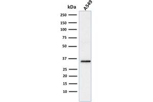 Western Blotting (WB) image for anti-SRY (Sex Determining Region Y)-Box 2 (SOX2) (AA 176-305) antibody (ABIN6940611)
