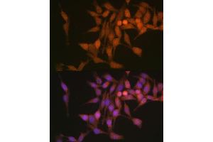Immunofluorescence analysis of HeLa cells using PSMB6 Polyclonal Antibody (ABIN1682336, ABIN3018469, ABIN3018470 and ABIN6220475) at dilution of 1:100 (40x lens). (PSMB6 抗体  (AA 35-239))
