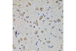 Immunohistochemistry of paraffin-embedded mouse brain using EIF4A2 antibody.
