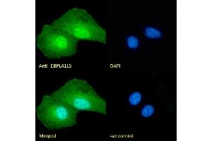 (ABIN238631) Immunofluorescence analysis of paraformaldehyde fixed A549 cells, permeabilized with 0.