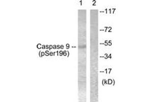 Western blot analysis of extracts from 293 cells treated with Calyculin 50nM 30', using Caspase 9 (Phospho-Ser196) Antibody. (Caspase 9 抗体  (pSer196))