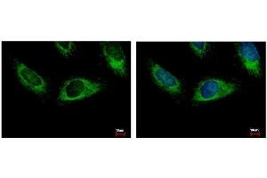 ICC/IF Image HPS3 antibody [C3], C-term detects HPS3 protein at cytoplasm by immunofluorescent analysis. (HPS3 抗体  (C-Term))