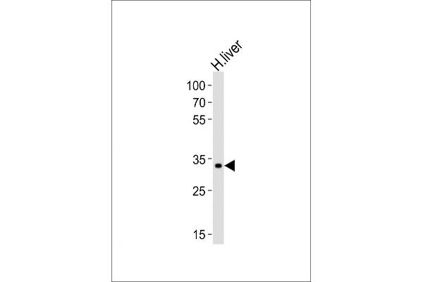 Leucine Rich Transmembrane and 0-Methyltransferase Domain Containing (LRTOMT) (AA 2-36), (N-Term) 抗体