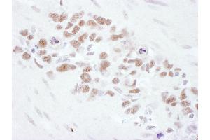 Immunohistochemistry (IHC) image for anti-MRE11 Meiotic Recombination 11 Homolog A (S. Cerevisiae) (MRE11A) (AA 658-708) antibody (ABIN7454999) (Mre11 抗体  (AA 658-708))