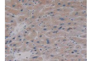 IHC-P analysis of Human Liver Tissue, with DAB staining. (AKT2 抗体  (AA 142-412))