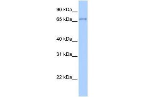 WB Suggested Anti-ZNF76 Antibody Titration:  0. (ZNF76 抗体  (Middle Region))