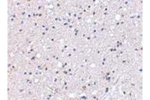 Immunohistochemical staining of human brain tissue using AP30384PU-N Grik4 antibody at 2. (GRIK4 抗体  (C-Term))