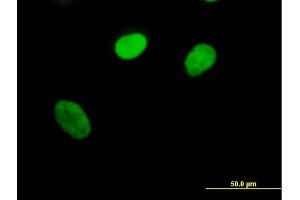 Immunofluorescence of purified MaxPab antibody to PPIE on HeLa cell.