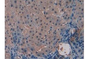 Immunohistochemistry (IHC) image for anti-Alanine Aminotransferase (ALT) (AA 147-263) antibody (ABIN7438472)